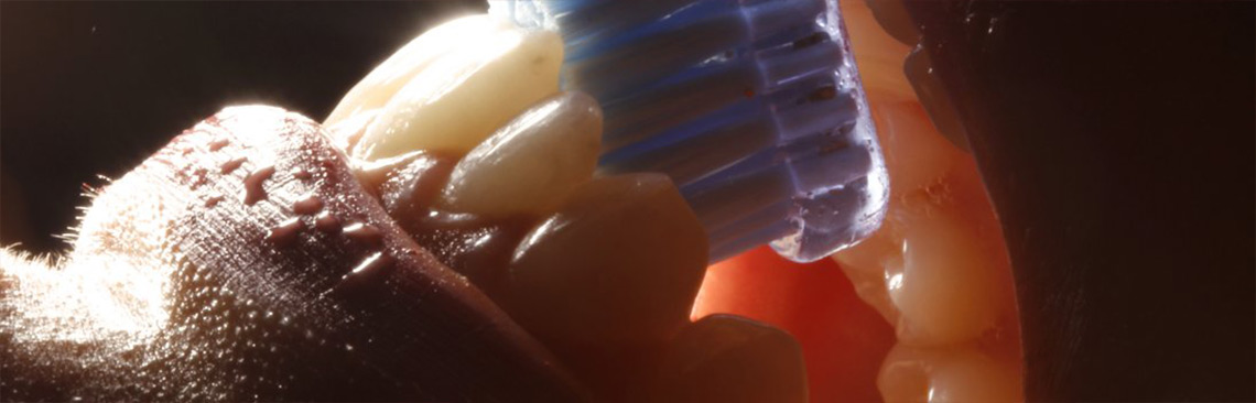 Imagem ilustrativa relacionada a implantes e reabilitação oral